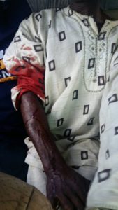Victim of violence at Ido Osun 