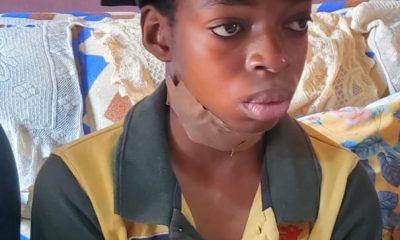 UITH Successfully Operates 13-yr-old Throat Tumor Patient, Emmanuel Nwafor