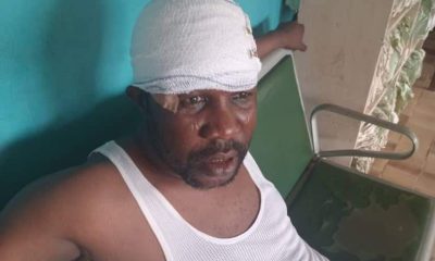 APC Chieftains Injured,As Violence Mars APC Primary In Ondo
