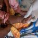 Sweden Reports First Case Of Contagious Mpox Variant