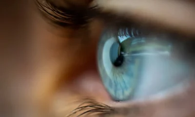 Seafood Virus Linked To Emerging Human Eye Disease –Study