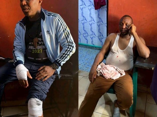 Sowore, Others Hospitalised After Suspected Political Thugs’ Attack in Ekiti